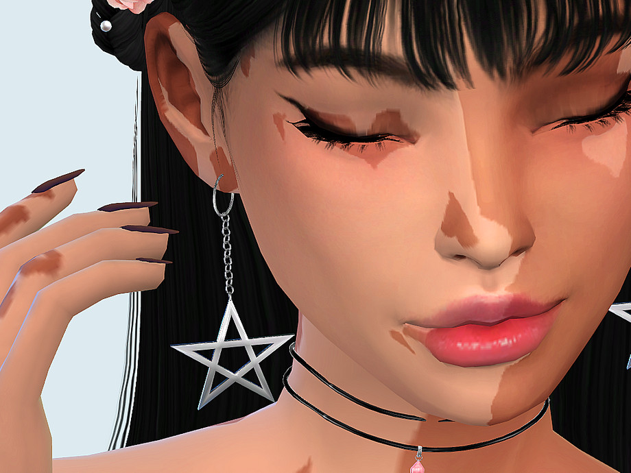The Sims Resource - Skin Detail| Vitiligo Set No. 2